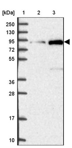 Lane 1: Marker [kDa] 250, 130, 95, 72, 55, 36, 28, 17, 10_br/_Lane 2: Human cell line RT-4_br/_Lane 3: Human cell line U-251MG sp