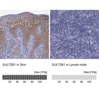 Anti-SULT2B1 Antibody