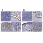 Anti-SULT2B1 Antibody