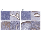 Immunohistochemical staining of human lymph node, prostate, skin and small intestine using Anti-SULT2B1 antibody HPA043539 (A) shows similar protein distribution across tissues to independent antibody HPA041724 (B).
