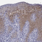 Immunohistochemical staining of human skin shows strong nuclear positivity in squamous epithelial cells.