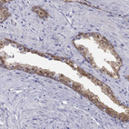 Anti-SULT2B1 Antibody