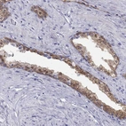 Immunohistochemical staining of human prostate shows strong granular cytoplasmic positivity in glandular cells.