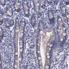 Immunohistochemical staining of human small intestine shows weak cytoplasmic positivity in glandular cells.