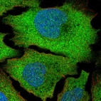 Immunofluorescent staining of human cell line U-2 OS shows localization to plasma membrane.