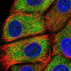 Immunofluorescent staining of human cell line MCF7 shows localization to cytosol.