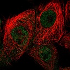 Anti-CDKN2D Antibody