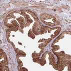 Immunohistochemical staining of human prostate shows strong granular cytoplasmic positivity in glandular cells.
