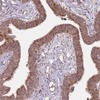 Immunohistochemical staining of human Fallopian tube shows strong granular cytoplasmic positivity in glandular cells.