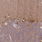 Immunohistochemical staining of human cerebellum shows moderate granular cytoplasmic positivity in Purkinje cells and Bergmann glia.