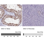 Anti-SAE1 Antibody