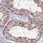 Immunohistochemical staining of human testis shows high expression.