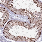 Immunohistochemical staining of human testis shows high expression.