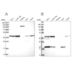 Western blot analysis using Anti-SAE1 antibody HPA043552 (A) shows similar pattern to independent antibody HPA041906 (B).