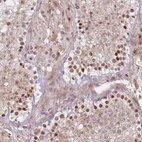Anti-ERICH6B Antibody
