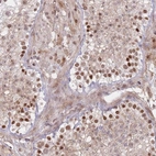 Anti-ERICH6B Antibody