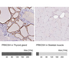 Anti-PRKCSH Antibody