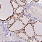 Immunohistochemical staining of human thyroid gland shows high expression.