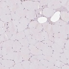 Immunohistochemical staining of human skeletal muscle shows low expression as expected.