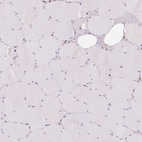 Anti-PRKCSH Antibody