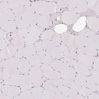 Immunohistochemical staining of human skeletal muscle shows low expression as expected.