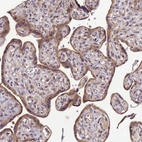 Immunohistochemical staining of human placenta shows moderate cytoplasmic positivity in trophoblastic cells.
