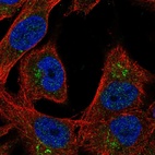 Immunofluorescent staining of human cell line SK-MEL-30 shows localization to the Golgi apparatus.