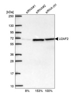 Western blot analysis in U2OS cells transfected with control siRNA, target specific siRNA probe #1 and #2, using Anti-U2AF2 antibody. Remaining relative intensity is presented.
