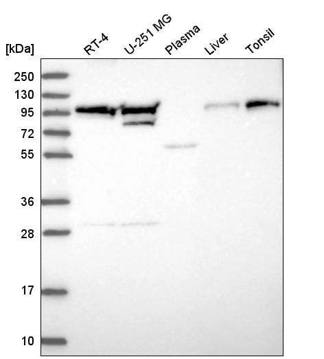 Anti-EVI5L Antibody