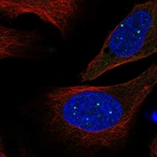 Anti-EVI5L Antibody