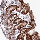 Immunohistochemical staining of human stomach shows strong membranous and cytoplasmic positivity in glandular cells.