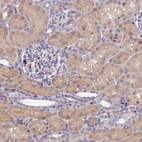 Immunohistochemical staining of human kidney shows weak cytoplasmic positivity in cells in tubules.
