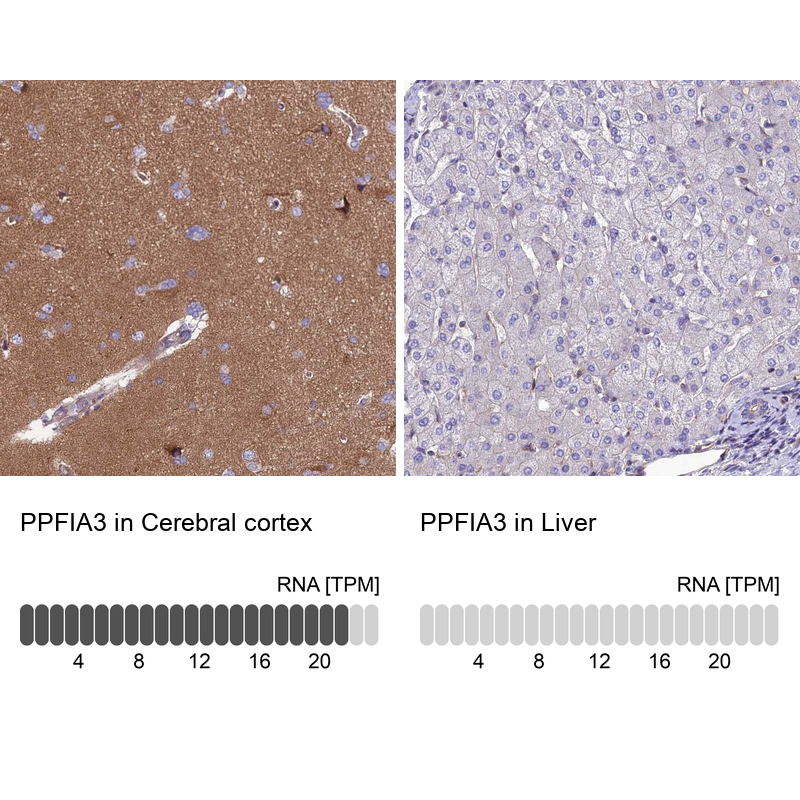 Anti-PPFIA3 Antibody