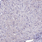 Immunohistochemical staining of human liver shows low expression as expected.