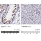 Anti-CCDC97 Antibody