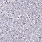Anti-CCDC97 Antibody