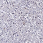 Immunohistochemical staining of human liver shows low expression as expected.