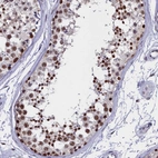 Immunohistochemical staining of human testis shows high expression.