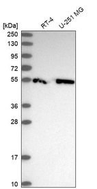 Western blot analysis in human cell line RT-4 and human cell line U-251 MG.