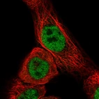 Immunofluorescent staining of human cell line A-431 shows localization to nucleoplasm.