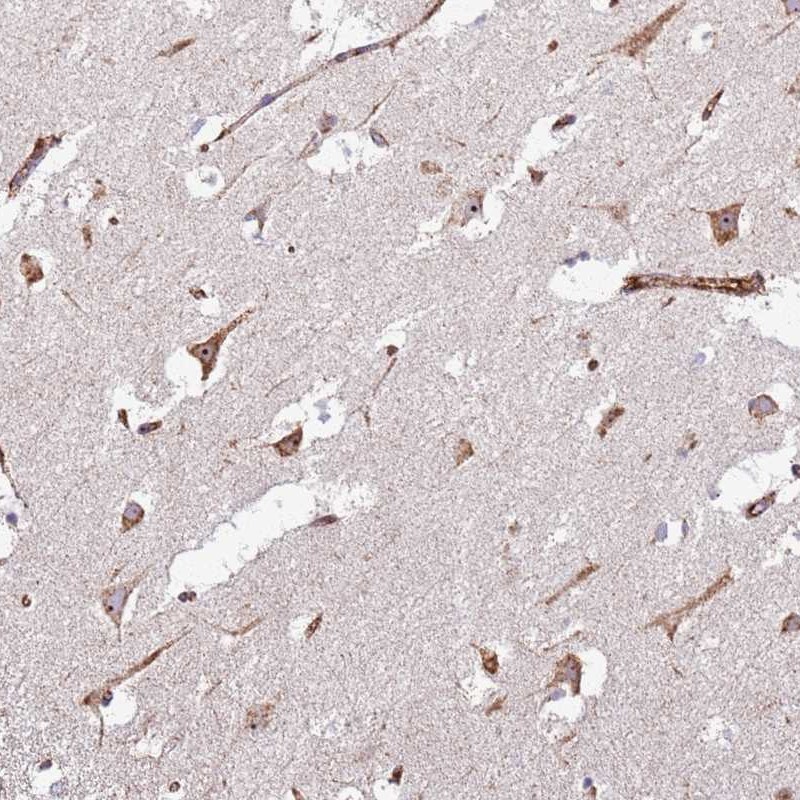 Anti-KRI1 Antibody