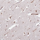 Anti-KRI1 Antibody