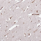 Anti-KRI1 Antibody