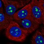 Immunofluorescent staining of human cell line MCF7 shows localization to nucleoli.