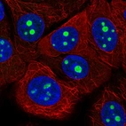 Immunofluorescent staining of human cell line MCF7 shows localization to nucleoli.