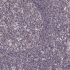 Immunohistochemical staining of human lymph node shows moderate nuclear positivity in lymphoid cells.