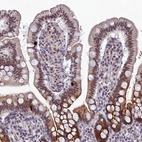 Immunohistochemical staining of human small intestine shows moderate nuclear positivity in glandular cells.