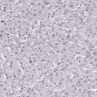 Immunohistochemical staining of human liver shows no positivity in hepatocytes as expected.