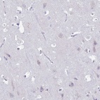 Immunohistochemical staining of human cerebral cortex shows low expression as expected.