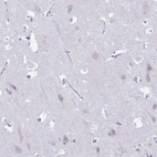 Immunohistochemical staining of human cerebral cortex shows low expression as expected.